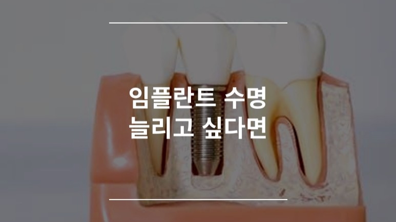 임플란트 수명 늘리고 싶다면