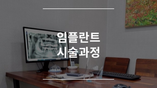 임플란트 시술과정
