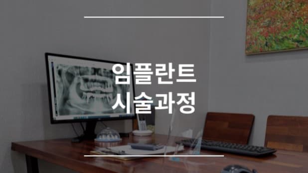 임플란트 시술과정